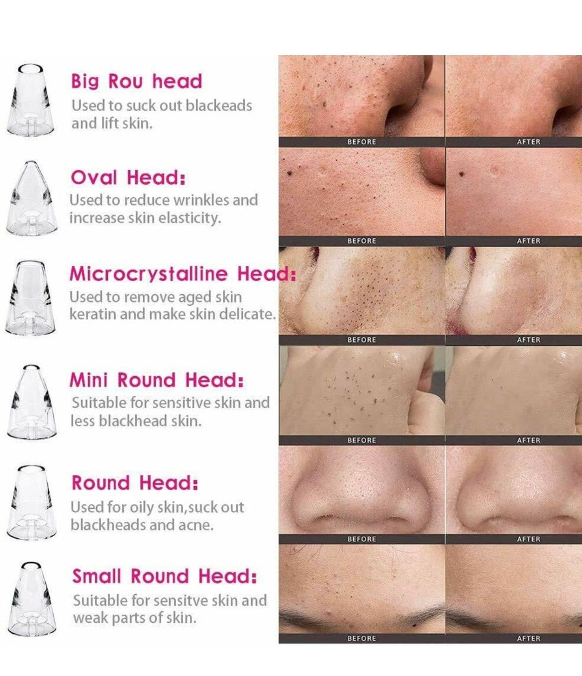 Electric Blackhead Remover Vacuum – 6 Head Multi-Functional Pore Cleaner✨