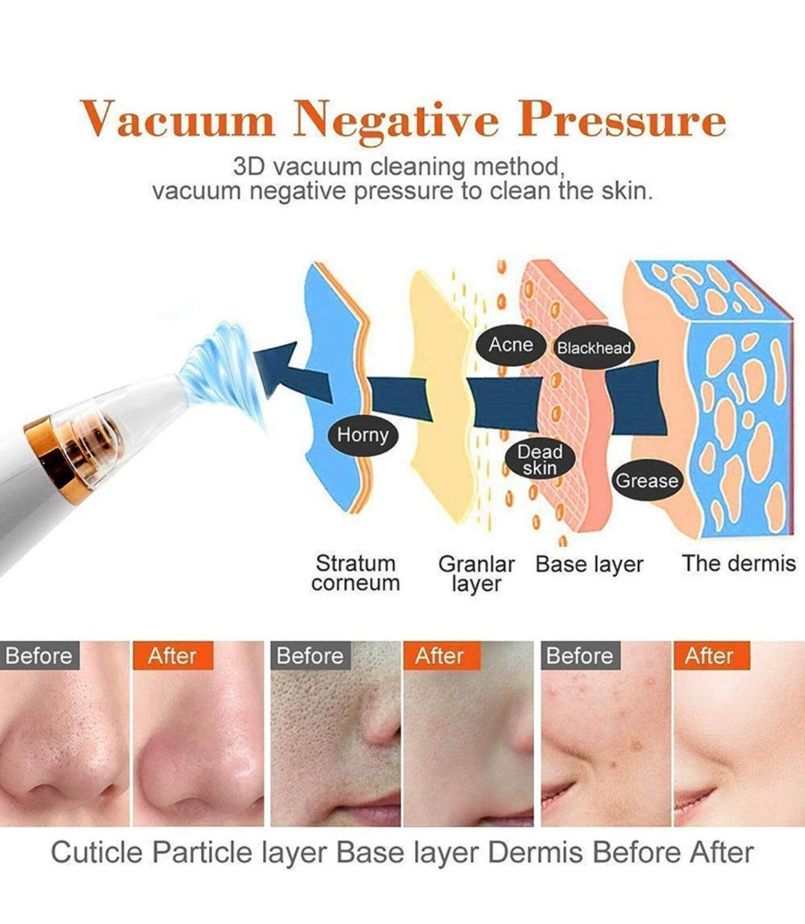 Electric Blackhead Remover Vacuum – 6 Head Multi-Functional Pore Cleaner✨