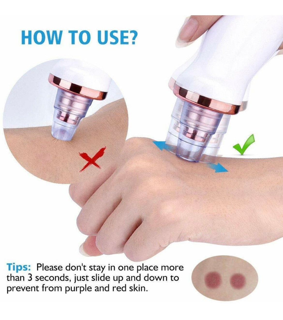 Electric Blackhead Remover Vacuum – 6 Head Multi-Functional Pore Cleaner✨